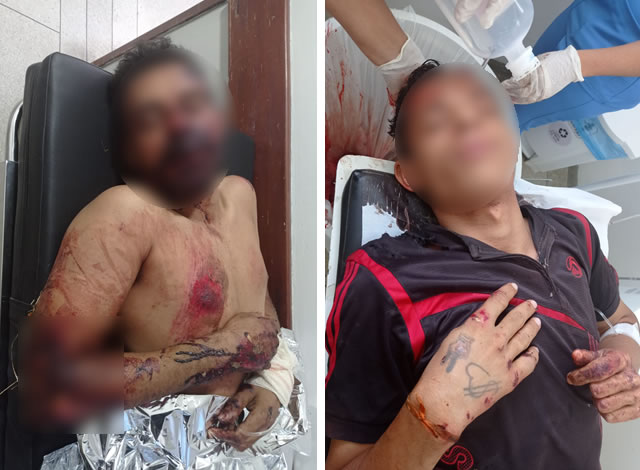 Dupla fica gravemente ferida após tentativa de assalto na PB-383 no sertão paraibano