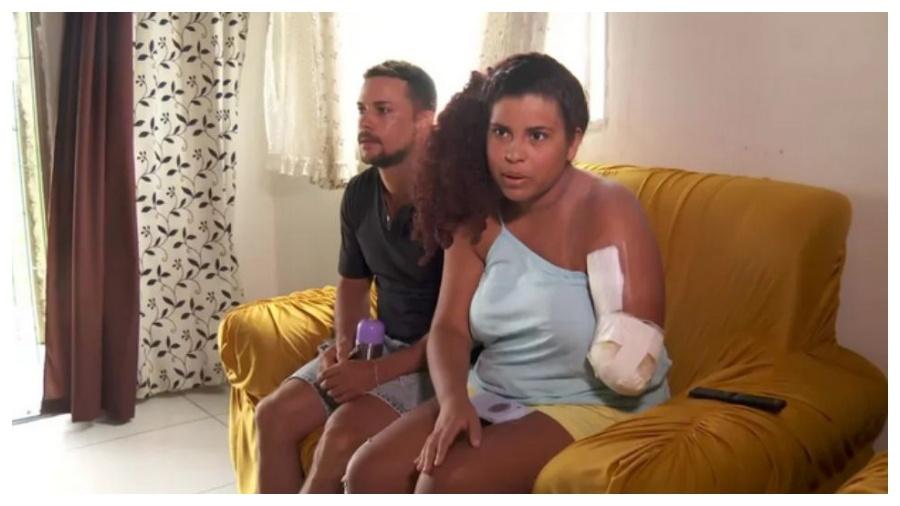 SUPERAÇÃO: Jovem mordida por tubarão em Recife confundiu mordida com brincadeira