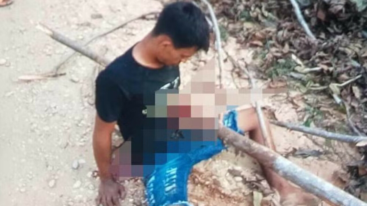 SURPREENDENTE: Rapaz fica com tronco atravessado no peito após acidente de moto
